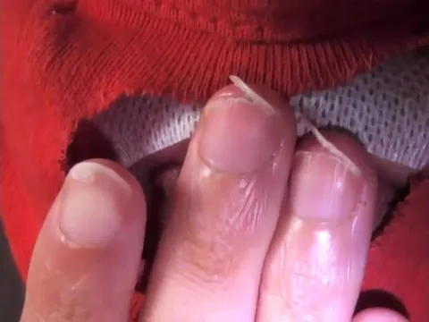 86 - Olivier nails bitter fingers..